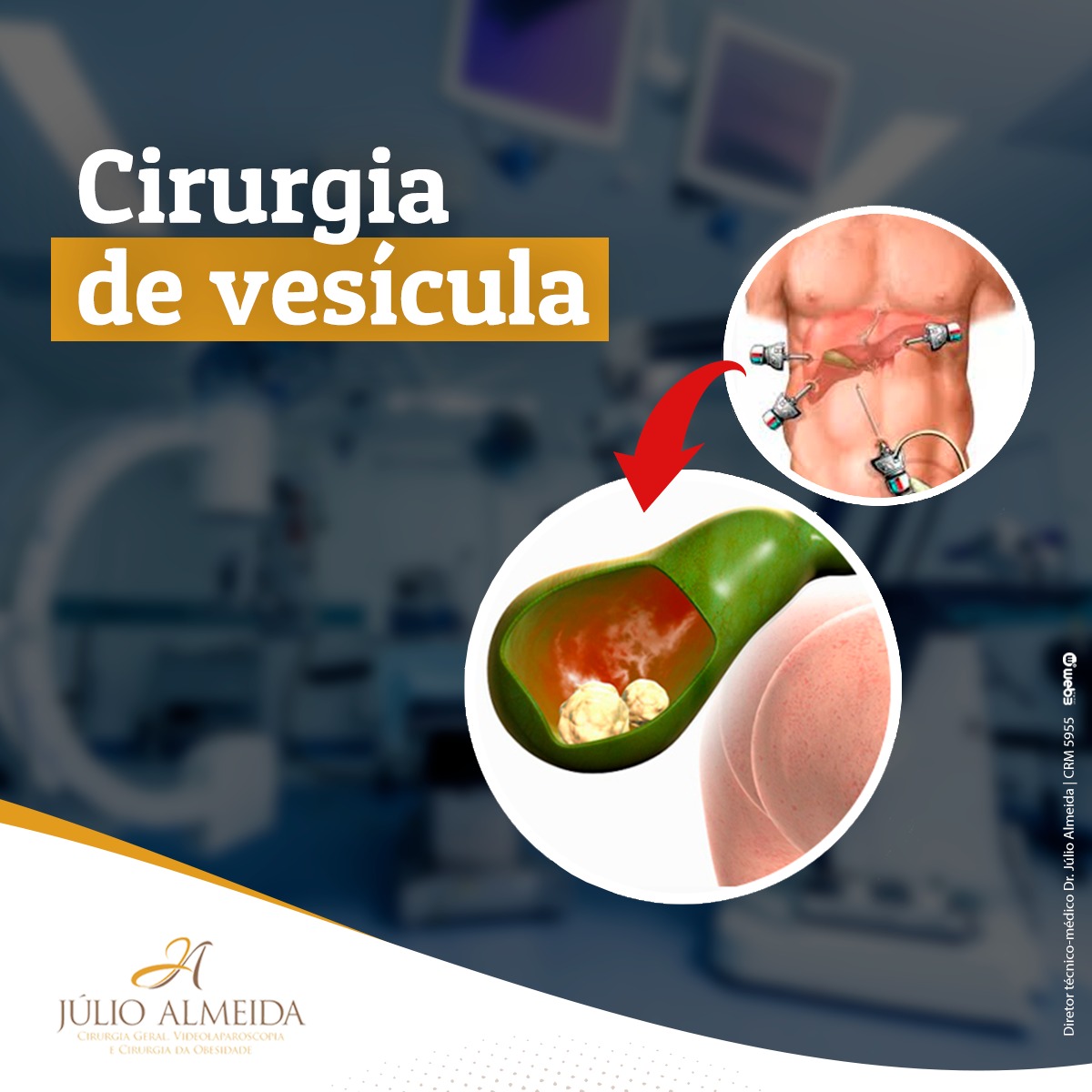Dr Alexandre - Cirurgia de vesícula